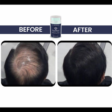CeeWoo Hair Building Fiber