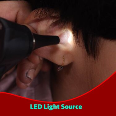 Otoscope Pen lens with Acrylic lens (ECL)