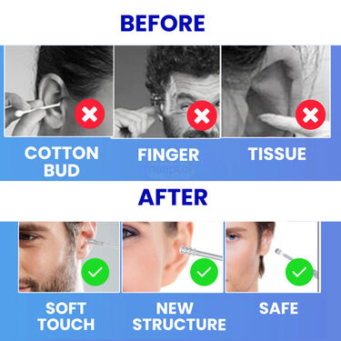 Ear Wax Cleaner - Buy 1 Get 1 Free (EDC)