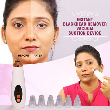 Instant Blackhead Remover Vacuum Suction Device (BVD)