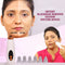 Instant Blackhead Remover Vacuum Suction Device (BVD)
